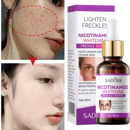SADOER Nicotinamide Whitening In Pakistan